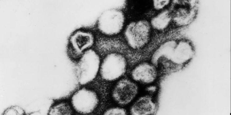 Naukowcy poinformowali, że odkryto dwa groźne wirusy podobne do różyczki. Jeden znaleziono w lasach Ugandy, drugi w niemieckim zoo.