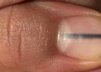 Makijażystka zauważyła to na paznokciu klientki. Uratowała jej życie