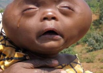 Dziecko „spłodzone przez diabła”, „kosmita”. Ojciec kazał je zabić, matka nie posłuchała…