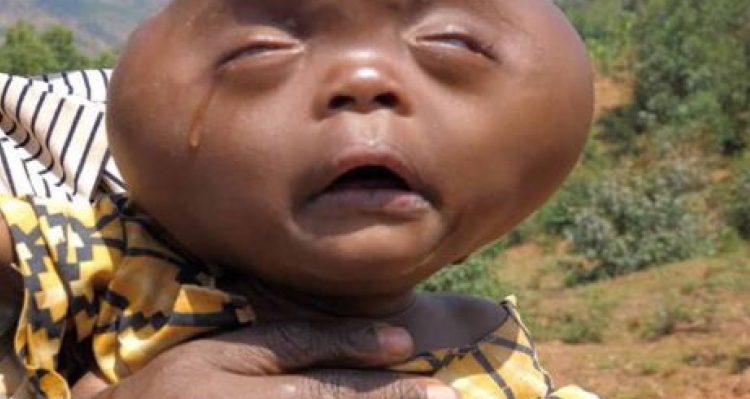 Dziecko „spłodzone przez diabła”, „kosmita”. Ojciec kazał je zabić, matka nie posłuchała…