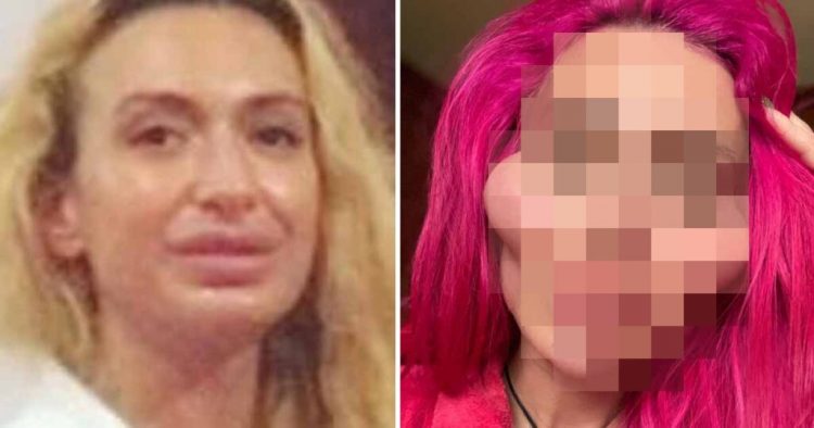 Operacje plastyczne zrobiły z niej potwora! Jej twarz już nie przypomina ludzkiej