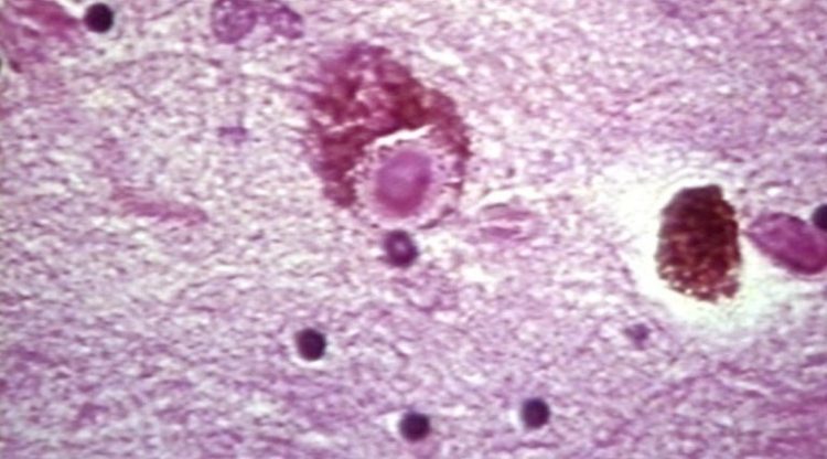 Jeżeli te symptomy się objawią, śmierć jest pewna. Dlaczego milczy się na ten temat?