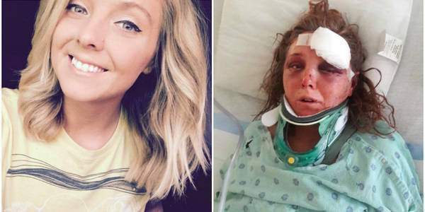 “Wsadził mi palce do ust i rozerwał język, próbował odgryźć palec, ucho, nos…” Skatowana kobieta trafiła do szpitala. “Ludzie udawali, że nic nie widzą”.