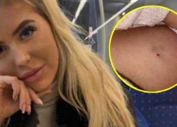 Historię tej kobiety powinien zobaczyć każdy. Pojechała na jarmark świąteczny z przyjaciółką, a przeszła przez piekło. Lepiej wiedzieć