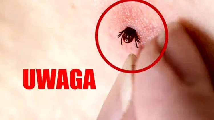 W Polsce trwają intensywne poszukiwania groźnego kleszcza wędrownego, znanego również jako kleszcz afrykański.