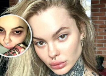 Monika Miller, 29-letnia aktorka i modelka, wnuczka byłego premiera Polski, Leszka Millera, podzieliła się swoją bolesną historią