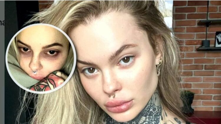 Monika Miller, 29-letnia aktorka i modelka, wnuczka byłego premiera Polski, Leszka Millera, podzieliła się swoją bolesną historią